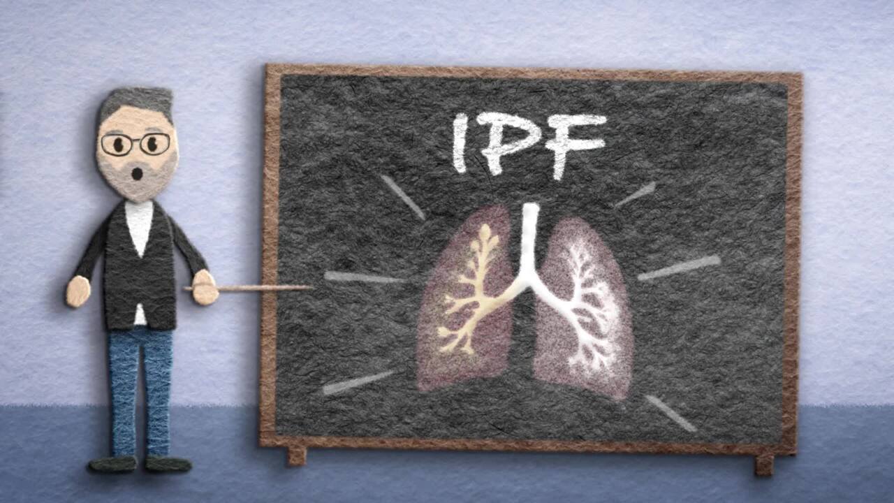 Video about IPF